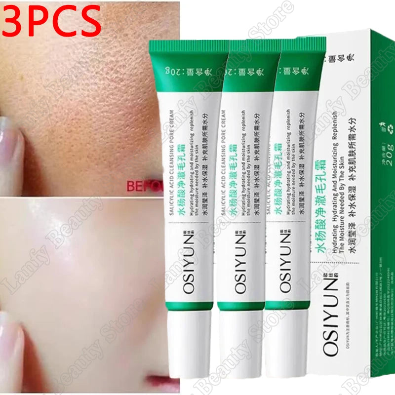 Salicylic Acid Pore Clearing Cream – Acne & Brightening Care