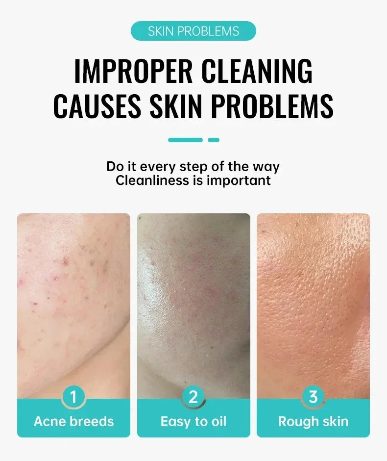 Salicylic Acid Acne Cream – Anti-Acne Repair & Pore Cleansing Skincare