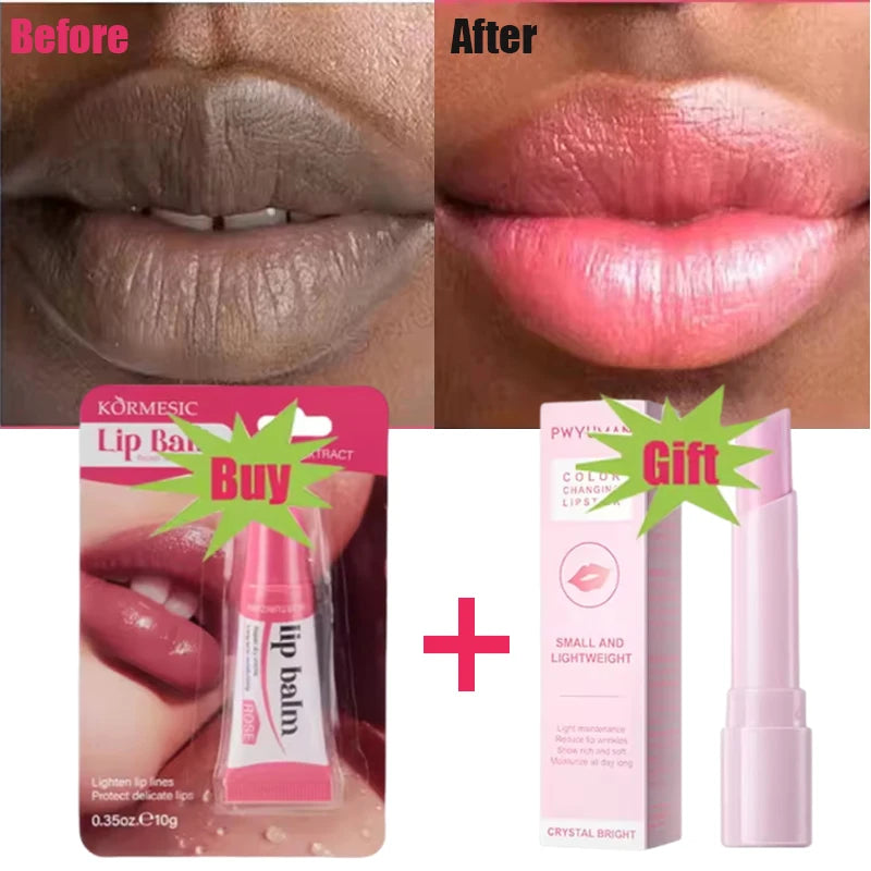 Dark Lip Lightening Balm – Exfoliating & Moisturizing Care