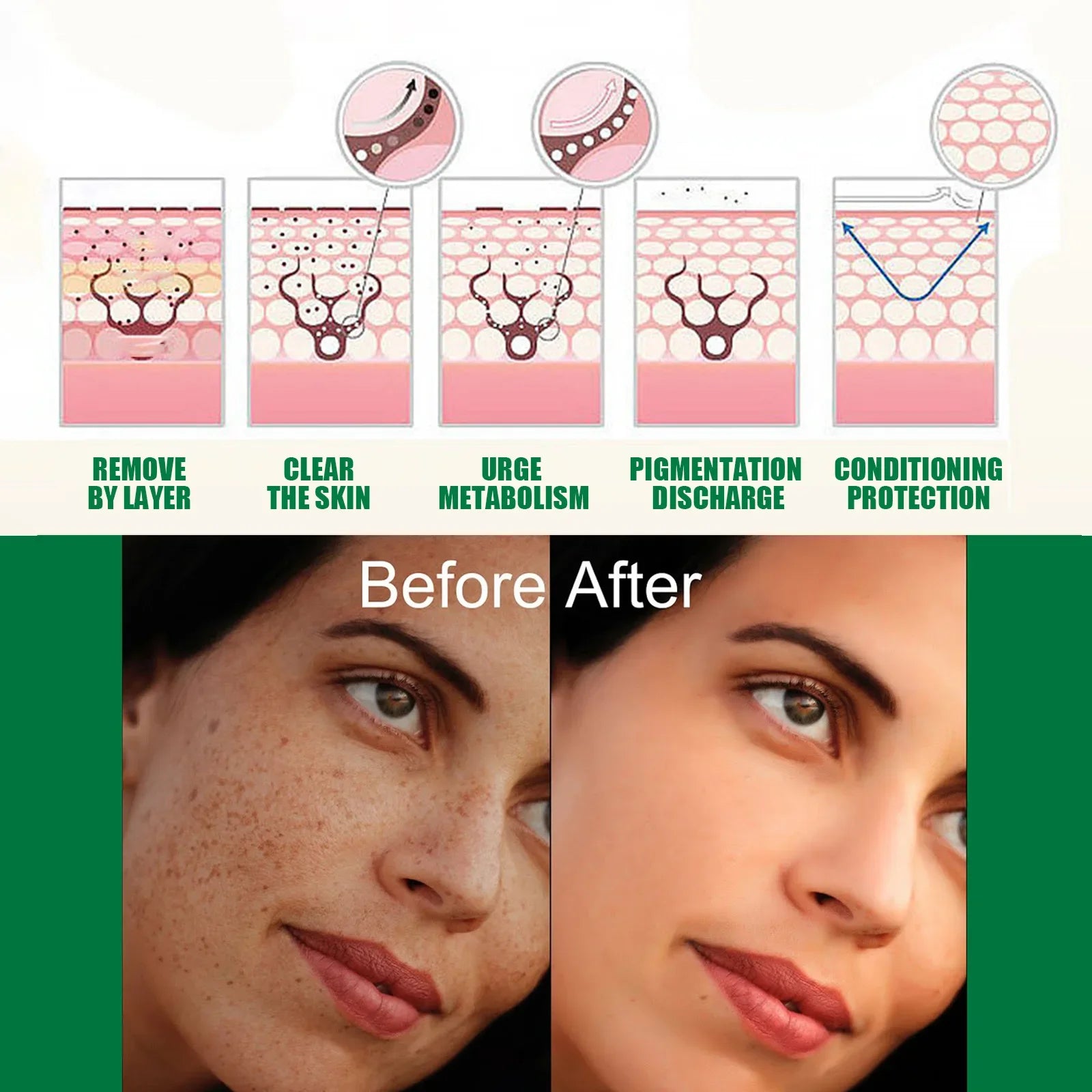 Whitening Freckle Serum – Brightening & Dark Spot Remover