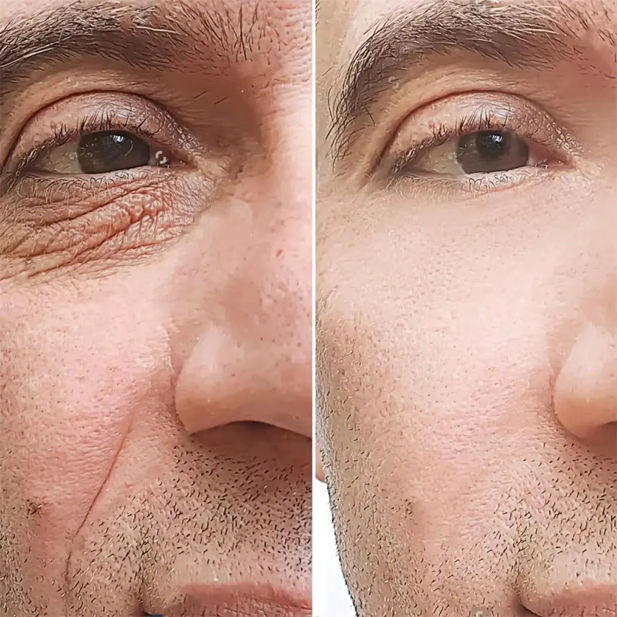 Men’s Retinol Anti-Wrinkle Cream – Collagen Firming & Moisturizing Skincare