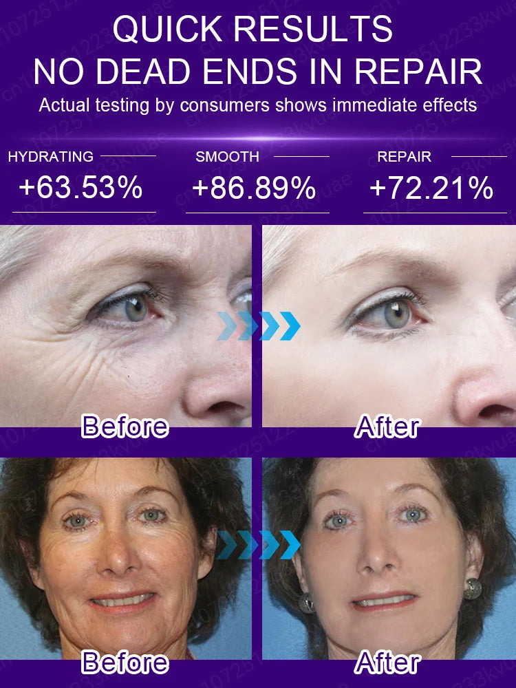 No Wrinkles Face Mask – 20 Years Younger Anti-Aging Treatment