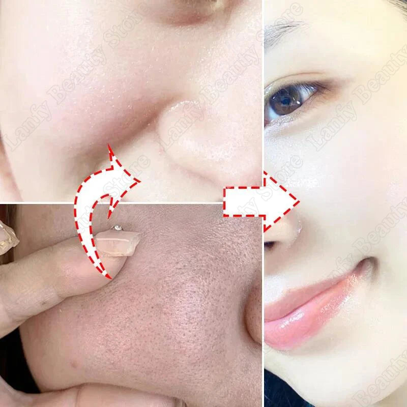 Salicylic Acid Pore Clearing Cream – Acne & Brightening Care