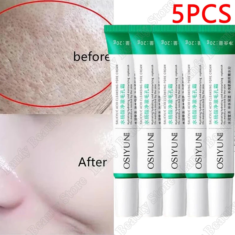 Salicylic Acid Pore Clearing Cream – Acne & Brightening Care