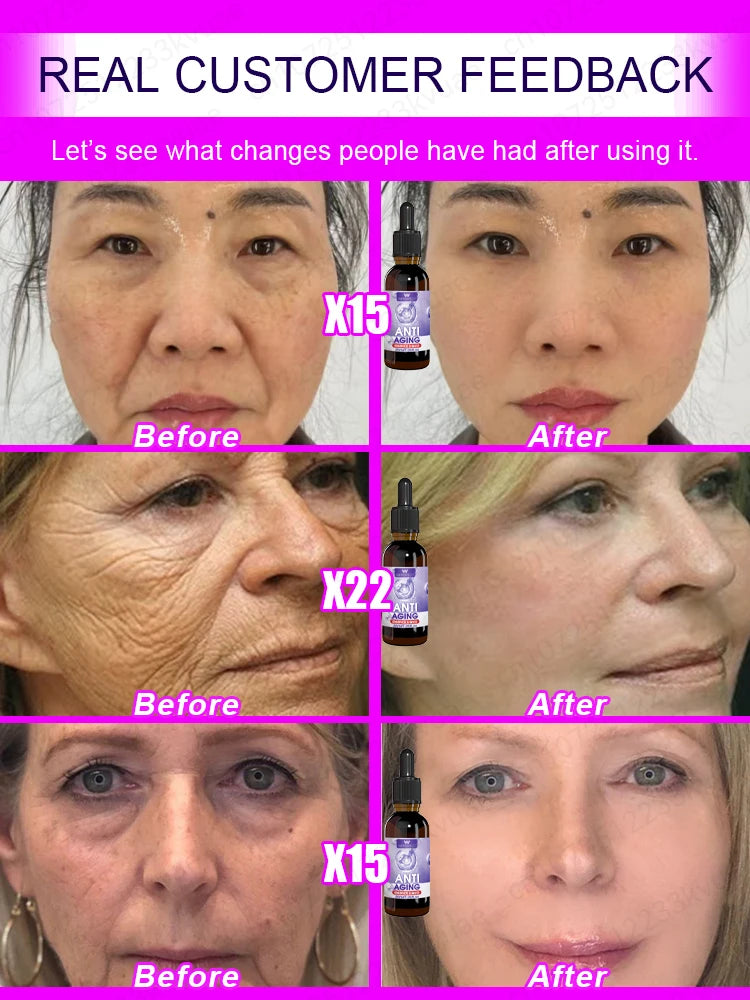 No Wrinkles Face Mask – 20 Years Younger Anti-Aging Treatment