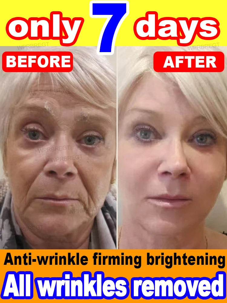 No Wrinkles Face Mask – 20 Years Younger Anti-Aging Treatment