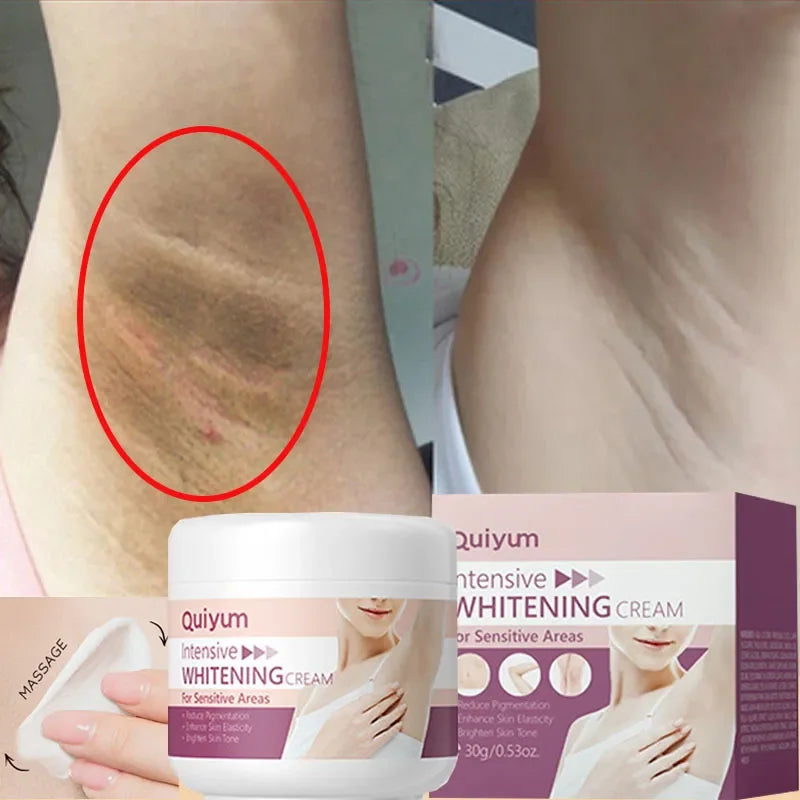 Whitening Cream – Underarm & Intimate Area Lightening Moisturizer