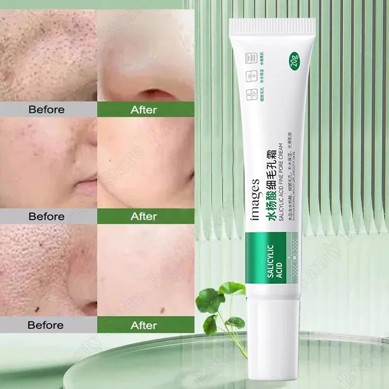 Salicylic Acid Pore Clearing Cream – Acne & Brightening Care
