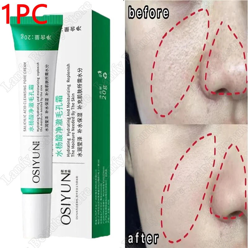 Salicylic Acid Pore Clearing Cream – Acne & Brightening Care