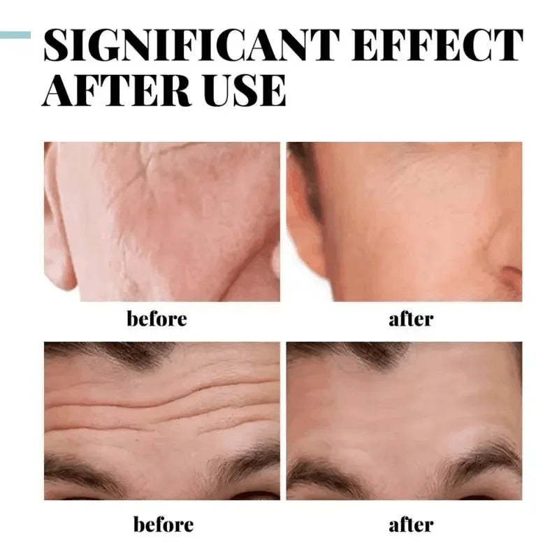 Men’s Retinol Anti-Wrinkle Cream – Collagen Firming & Moisturizing Skincare