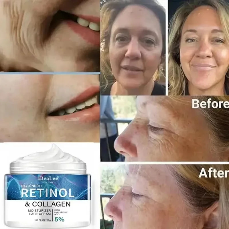 Men’s Retinol Anti-Wrinkle Cream – Collagen Firming & Moisturizing Skincare