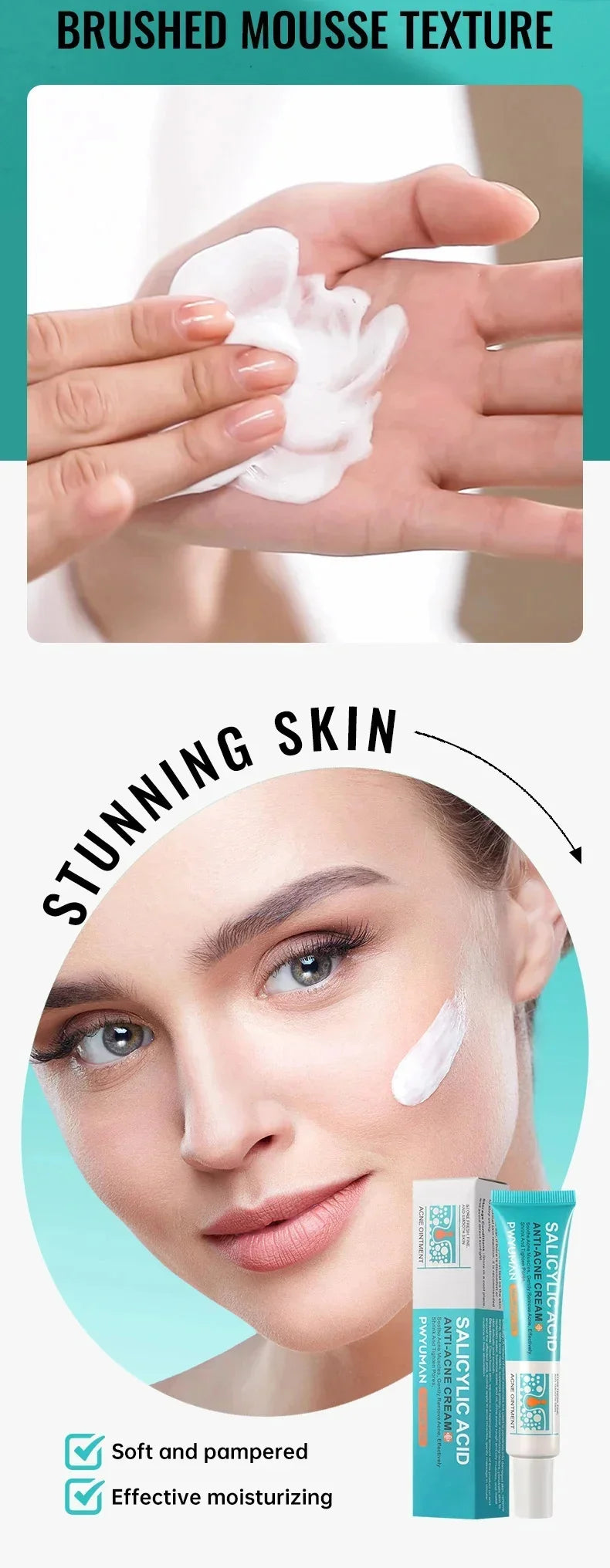 Salicylic Acid Acne Cream – Anti-Acne Repair & Pore Cleansing Skincare
