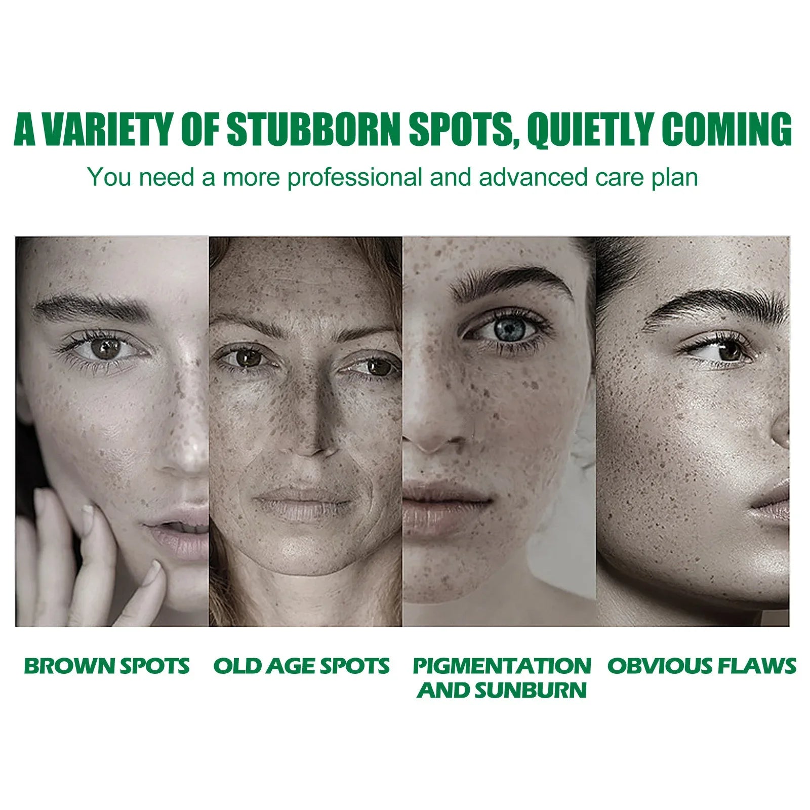 Whitening Freckle Serum – Brightening & Dark Spot Remover