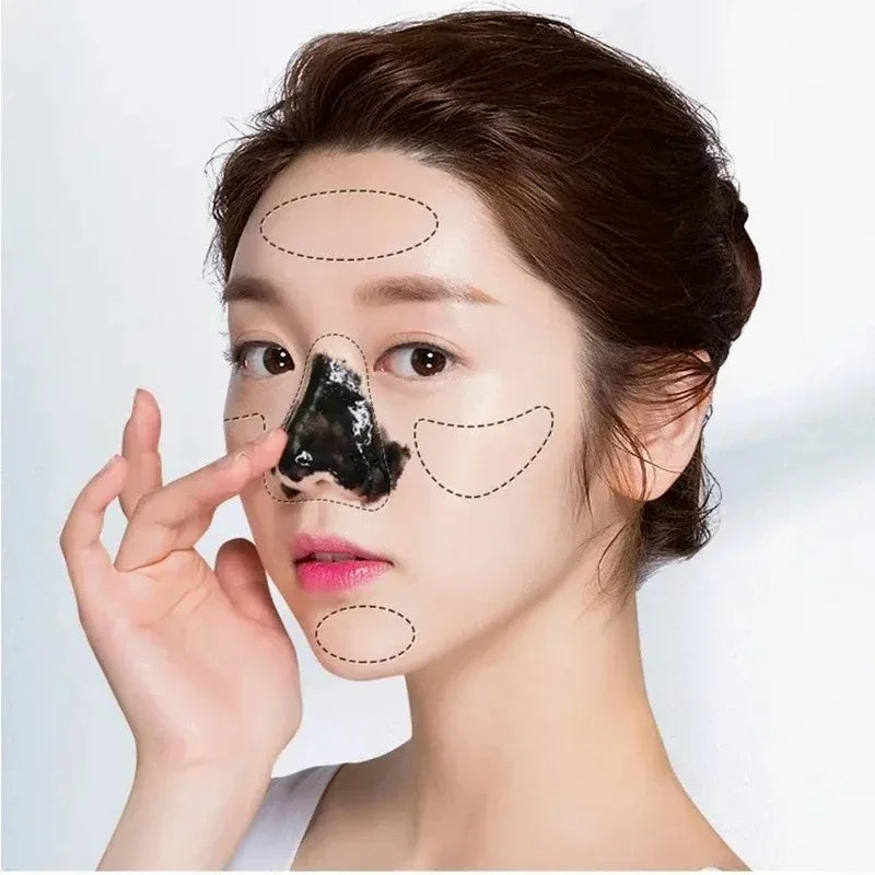 Blackhead Removal Mask – Deep Cleansing & Pore Tightening